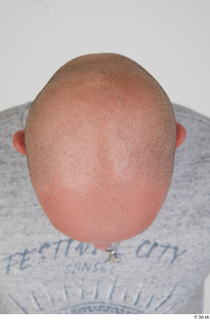  Photos Reece Griffiths bald head 0006.jpg